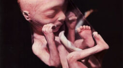 Abortion: Setting the Matter Straight